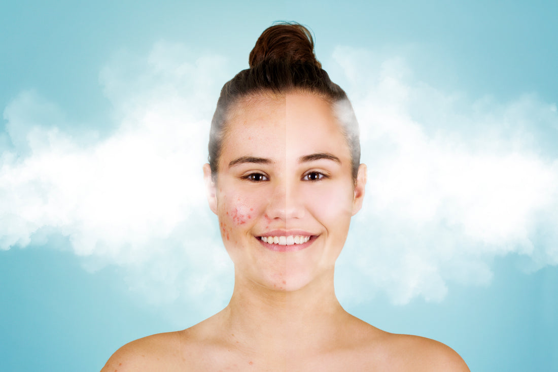 Uncover the Power of Cryoskin: Unlock Your Most Confident Self